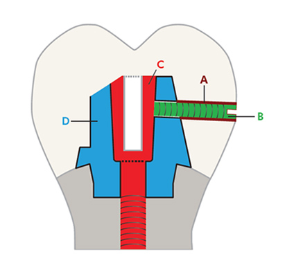 이빨 상세이미지