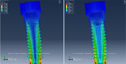 보철시스템 이미지2